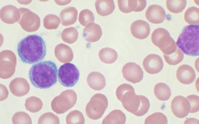 IDIAL_NET, el proyecto ibérico sobre la detección temprana de la leucemia